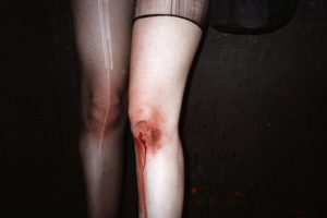 tumblr mn8ubdKdX61rfdcfvo1 1280